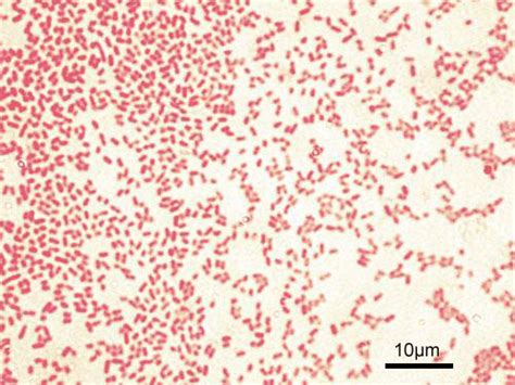 Gram Negative Bacteria Wikipedia