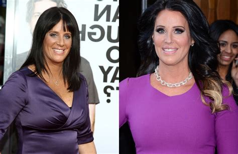 Patti Stanger Breasts Reduction Surgery Before And After Boob Job Photos