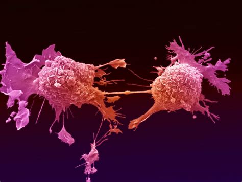 The Global Cancer Atlas Pursuit By The University Of Melbourne