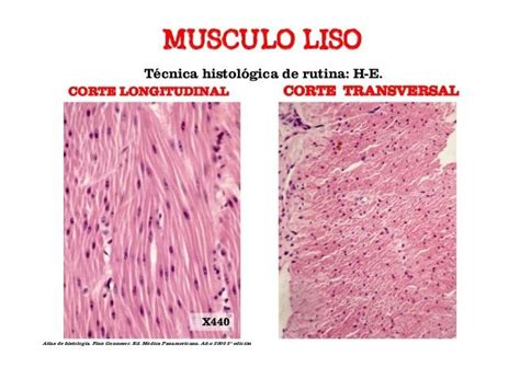 Apoyo Espalda P Ngase En Fila Histologia Tejido Muscular Esqueletico M Vil Medici N Aprovechar