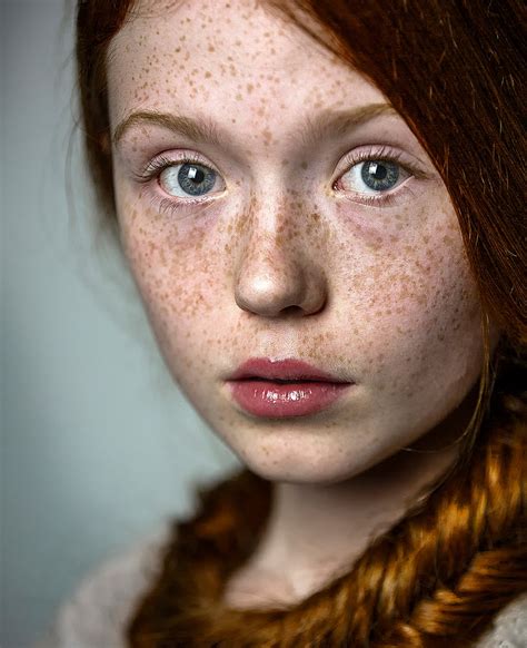 we love freckles photo contest winners