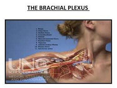 Brachial Plexus Injury Thoracic Outlet Syndrome Neck Pain Orlando