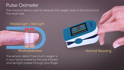 It is a quick, painless method to measure how well oxygen is being circulated throughout the body. Pulse Oximetry: Mechanism, History, Use and Sources of error