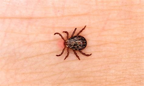 Treating Tick Bites First Aid Tips And Disease Prevention Fitpaa