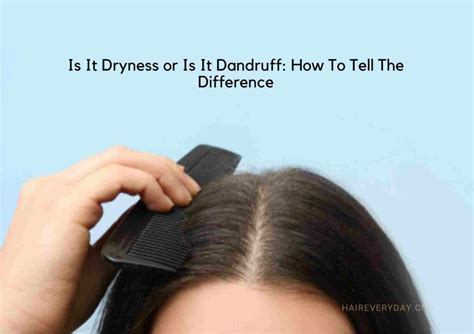 Dandruff Vs Dry Scalp Key Differences Causes And How To Treat Each