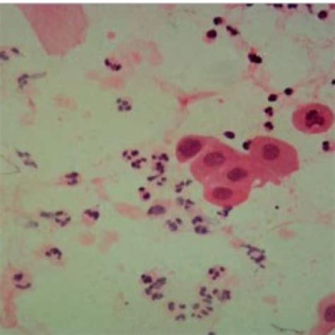Plate A Photomicrograph Of Vaginal Smear From Female Rat At Proestrus