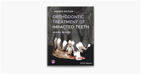 ‎orthodontic Treatment Of Impacted Teeth On Apple Books