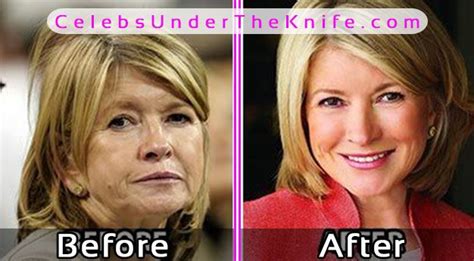 Martha Stewart Photos Before After Plastic Surgery Anti Aging