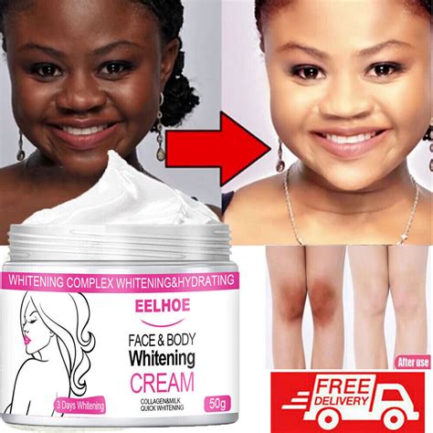 Unveiling The Truth About Skin Bleaching Products Separating Fact From