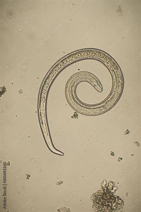 Trichinella Spiralis Parasitic Nematoda Worm Microscope Stock Photo