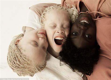 Albino Twins From São Paulo Become Models Daily Mail Online