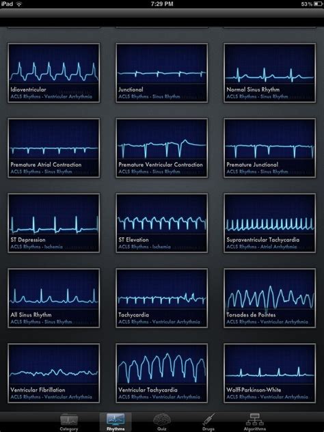 Acls Rhythm Strips Cheat Sheet