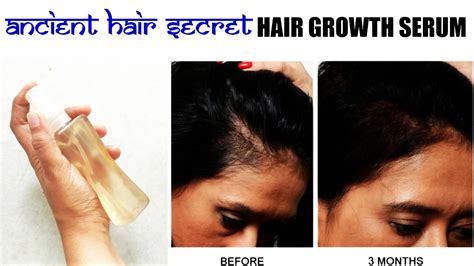 Cure Baldness Regrow Hair Fast Naturally Indian Hair Secrets Youtube