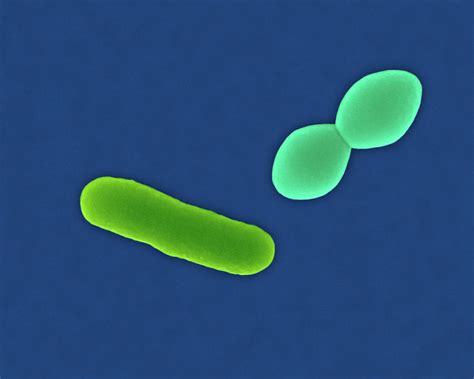 Streptococcus Pneumoniae 2 Photograph By Dennis Kunkel Microscopy