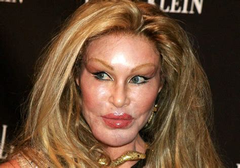 8 Celebrity Plastic Surgery Gone Bad Really Bad News Stories Latest News Headlines On Times