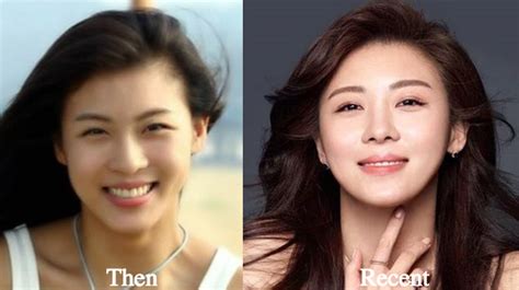 Ha Ji Won Plastic Surgery Before And After Photos