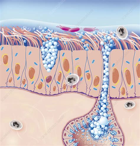 Cystic Fibrosis Illustration Stock Image C0481121 Science Photo