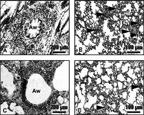 Representative Photomicrographs Of Airways A And C And Distal Lung