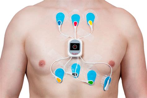 Siete Preguntas Y Sus Respuestas Sobre El Electrocardiograma Del