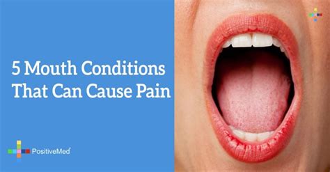5 Mouth Conditions That Can Cause Pain