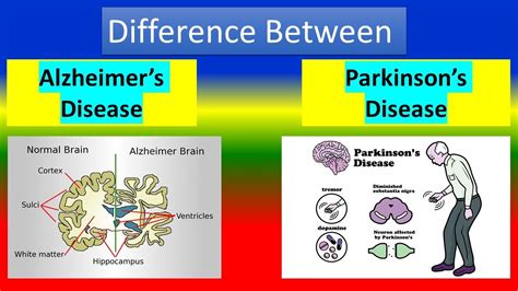 Mengenal Perbedaan Penyakit Parkinson Dan Alzheimer Sketsa Co