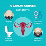 Common symptoms of ovarian cancer include bloating, pelvic pain, feeling full quickly, and urinary symptoms. Ovarian Cancer Symptoms - Medicare Solutions Blog