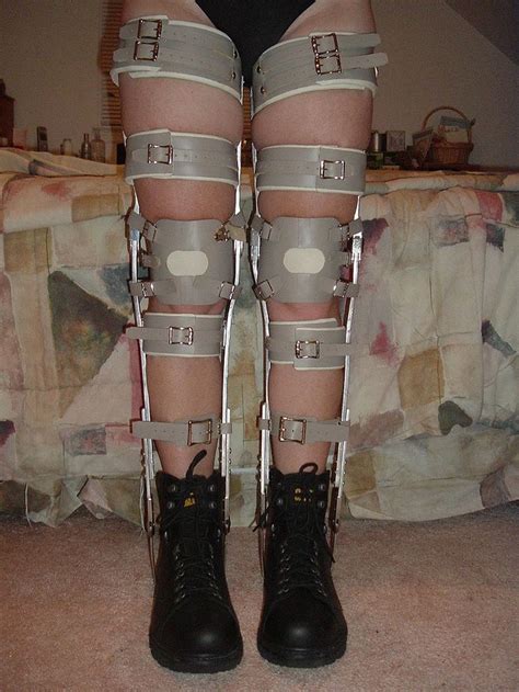 Boots And Taupe Braces From The Front Leg Braces Braces Girls Boots