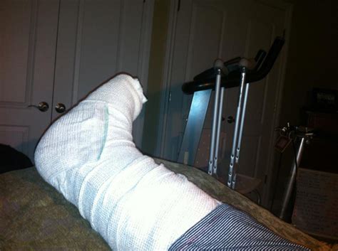 Injury or surgery involving the leg, ankle, or foot can also cause swelling. Foot Surgery FAQs: Answers Regarding Procedures Performed ...