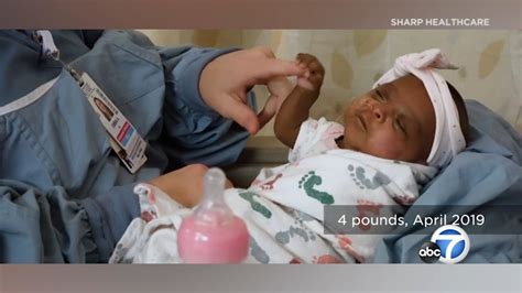Worlds Smallest Surviving Baby Heads Home From San Diego Hospital