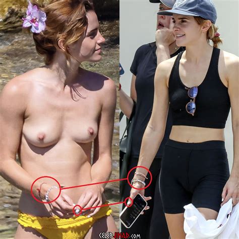 Emma Watson Nude Sunbathing Pics Published In A Tabloid