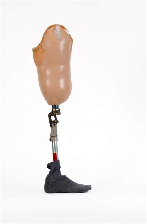 What Is A Prosthetic Leg With Pictures