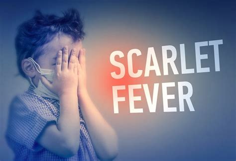 Scarlet Fever In Babies And Toddlers Causes Signs And Treatment