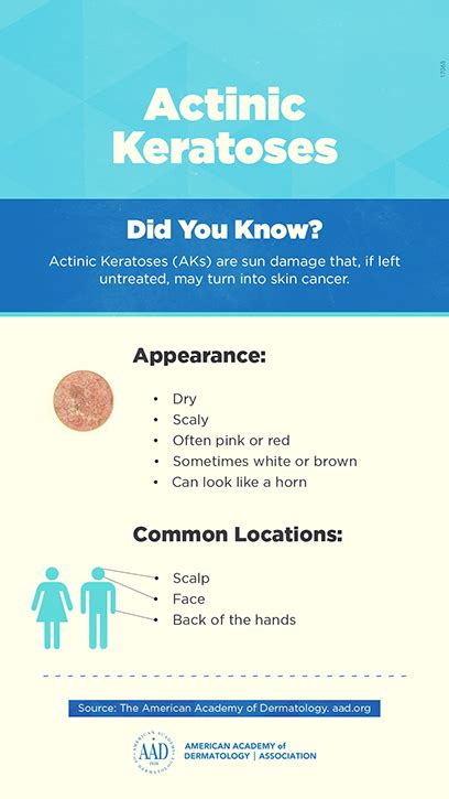 Treatments For Actinic Keratosis Ak St Louis Millstadt Saint Clair