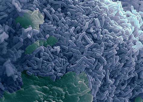 Bifidobacterium O Que é E Quais São Seus Benefícios Para A Saúde