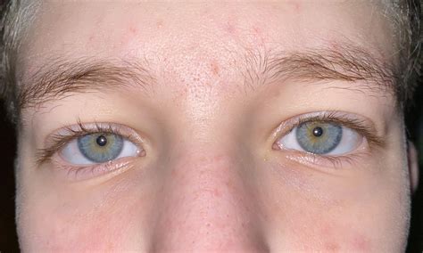 Is This Considered Central Heterochromia Or Hazel Ive Always Called