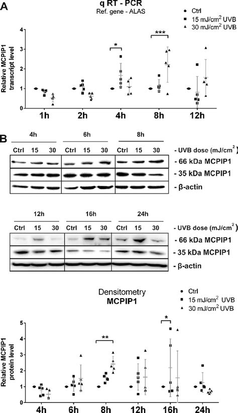 Uvb Radiation Activates Mcpip1 Expression Human Normal Keratinocytes