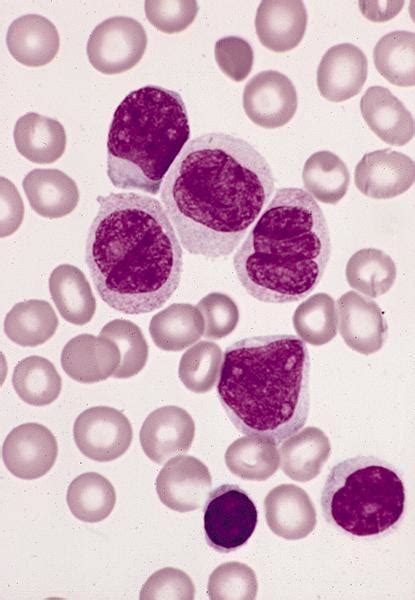 Monocyte Histology
