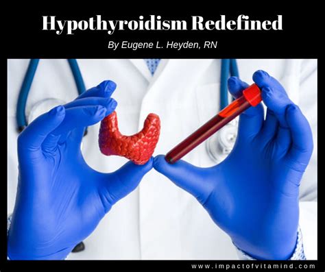 Hypothyroidism Redefined