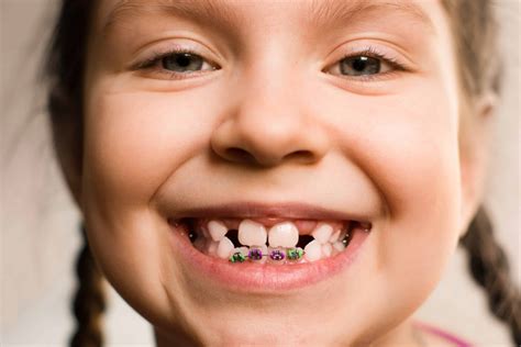 Orthodontics And The Premature Or Delayed Loss Of Baby Teeth Prairie