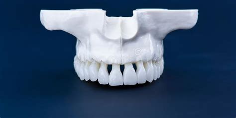 Upper Human Jaw With Teeth Stock Image Image Of Isolated 163141763