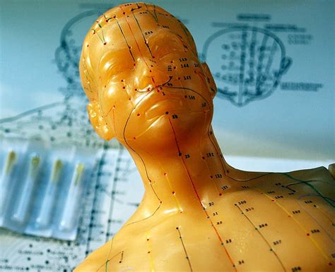 How To Find A Good Acupuncturist Chenzen Wellness Centre