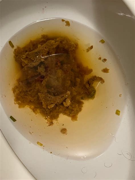 Abnormal Poop Has Been Like This For A Long Time Doctor Says Its Not