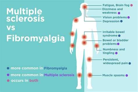 Fibromyalgia Vs Multiple Sclerosis Ms Differences In Signs Symptoms
