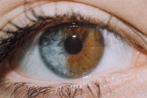 Rarest Eye Color Iris
