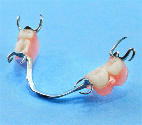 Partial Dentures For Back Teeth Stoughton Ma Periodontal Gum Disease