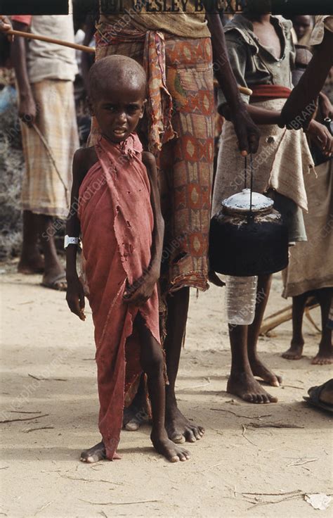 Starvation In Somalia Stock Image C0277925 Science Photo Library