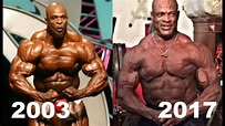 Ronnie Coleman Before & After Surgery | Ronnie Coleman is Back | 2018 ...