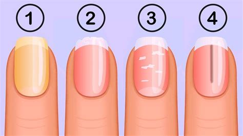 7 Things That Your Nails Say About Your Health How To Take Care Of