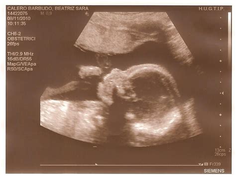 Para el buen desarrollo del embarazo es también importante que estés tranquila y vivas esta etapa de forma relajada. Rapyd2011: 23 semanas de embarazo.