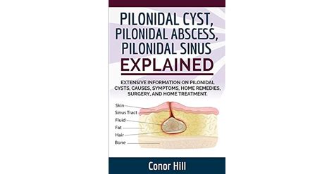 Pilonidal Cyst Pilonidal Abscess Pilonidal Sinus Explained
